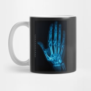 X-Ray Hand Mug